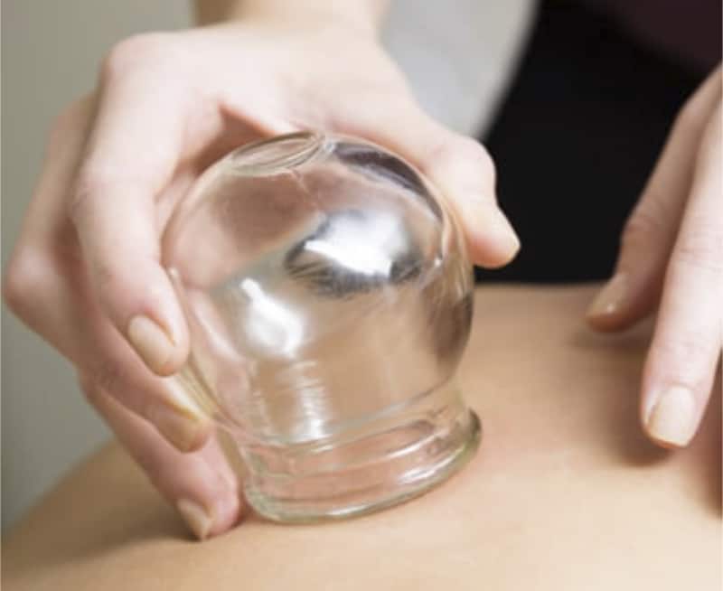 Gua sha and cupping on patient Scottsdale, AZ